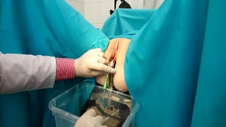 Amazing gyno exam